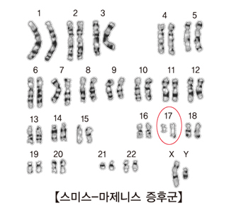 스미스-마제니스증후군