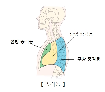 종격동염