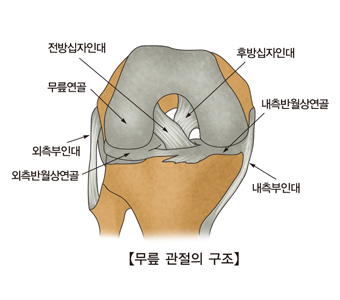 슬관절 장애