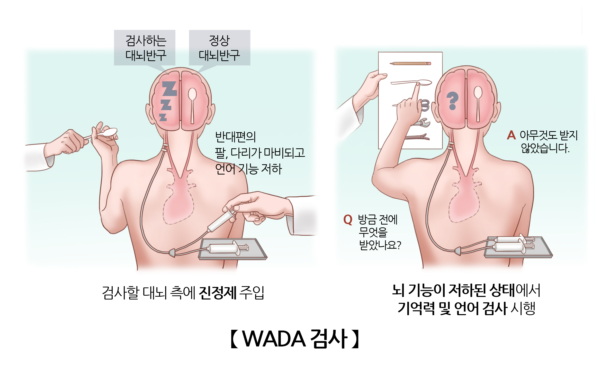 검사/시술/수술정보 | 의료정보 | 건강정보 | 서울아산병원